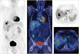 Clinical imaging with a PET/CT device